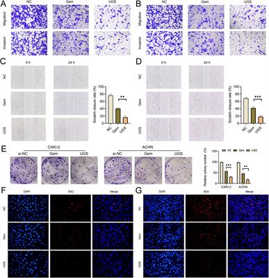 KHSRP knockdown inhibits papillary renal cell carcinoma progression and sensitizes to gemcitabine